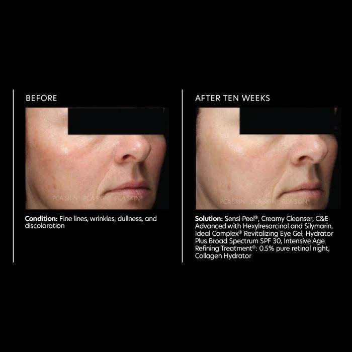 Advanced with Hexylresorcinol & Silymarin A162879
